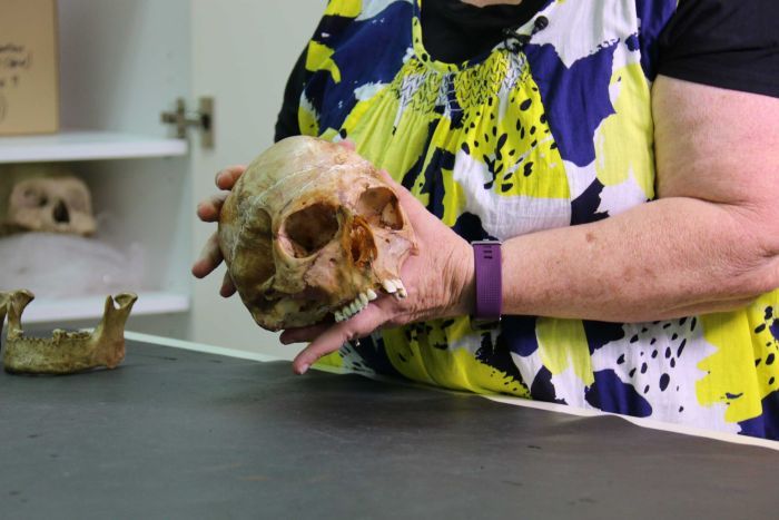 Christine Cave e uno dei crani da cui sono stati estratti i denti