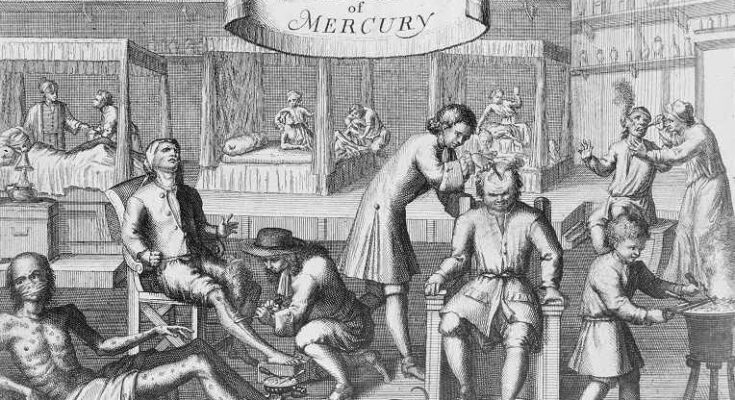 Londra, XVIII secolo: il paradiso della sifilide